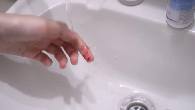 手与血液清洁在运行水龙头在水槽。