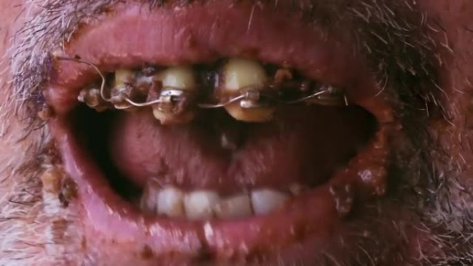 男人夸大了饼干的贪吃。带有缝隙和牙套的可怕的黄色牙齿的嘴吃糖果-暴食的概念。