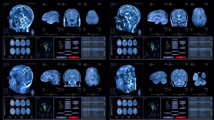 MRI脑扫描动画。神经内科数据，生命体征显示未来技术。HUD，界面概念。