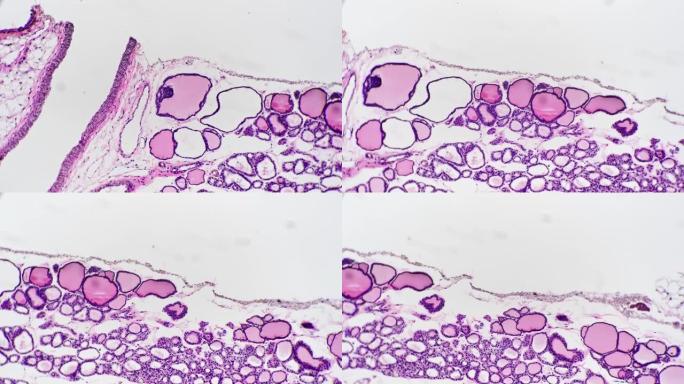 白色背景上高倍率100x拍摄的人类甲状旁腺细胞切片