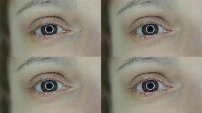 一个女人眼睛的特写。红眼睑伴有葡萄球菌感染的葡萄球菌感染。微距拍摄