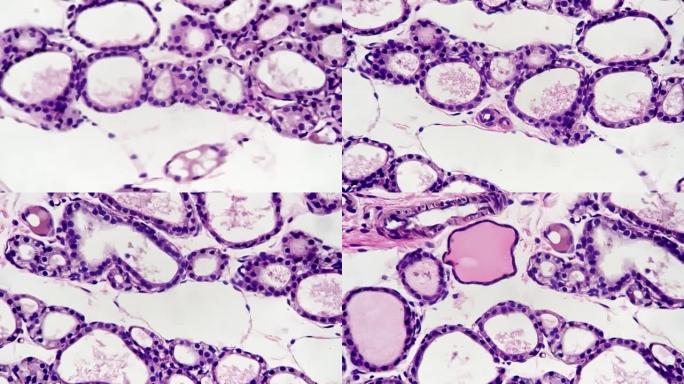 在白色背景上，甲状旁腺细胞放大了400倍，以解决教育问题