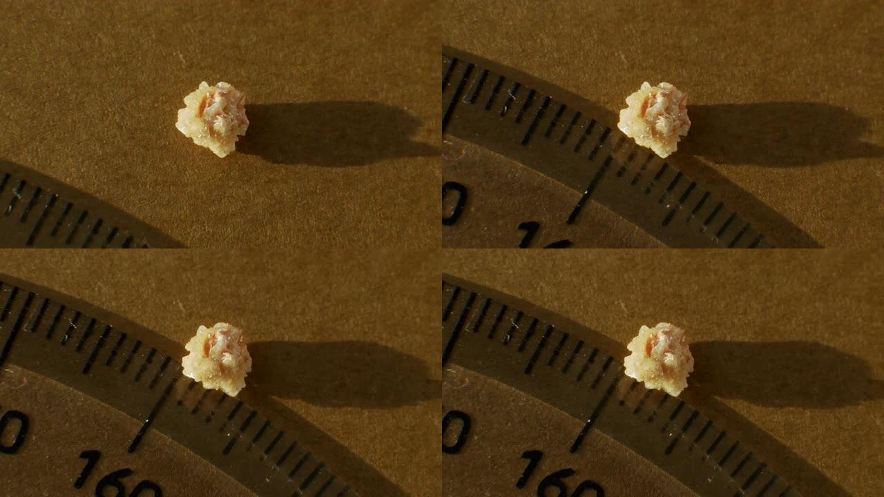 俯视图草酸盐结石从人体肾脏特写，用尺子测量结石的大小。人肾脏4毫米中的磷酸盐或尿酸盐结石。石头手术后