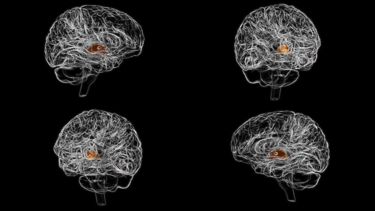 脑第三脑室解剖医学概念3D插图