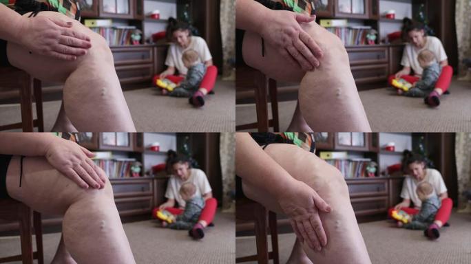 成熟的女人用静脉曲张按摩她的腿。