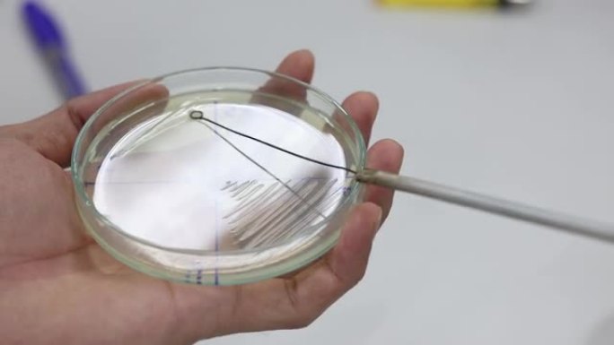 微生物实验室琼脂培养基平板上微生物的培养