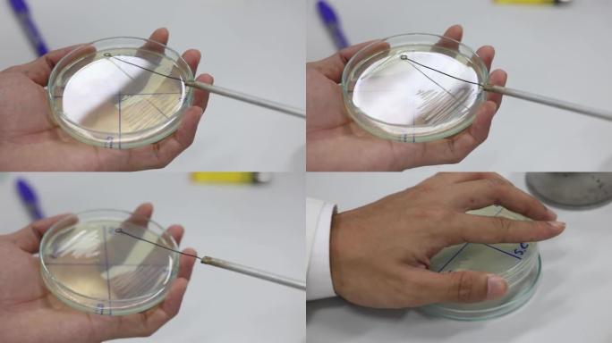 微生物实验室琼脂培养基平板上微生物的培养