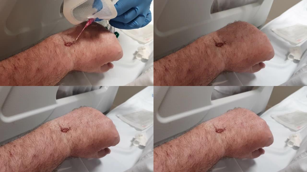 一名护士从医院的一名男子手臂上取下针头