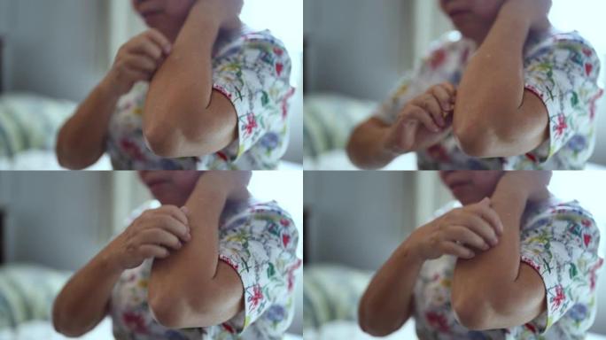 亚洲老年妇女瘙痒和抓挠她的手臂。