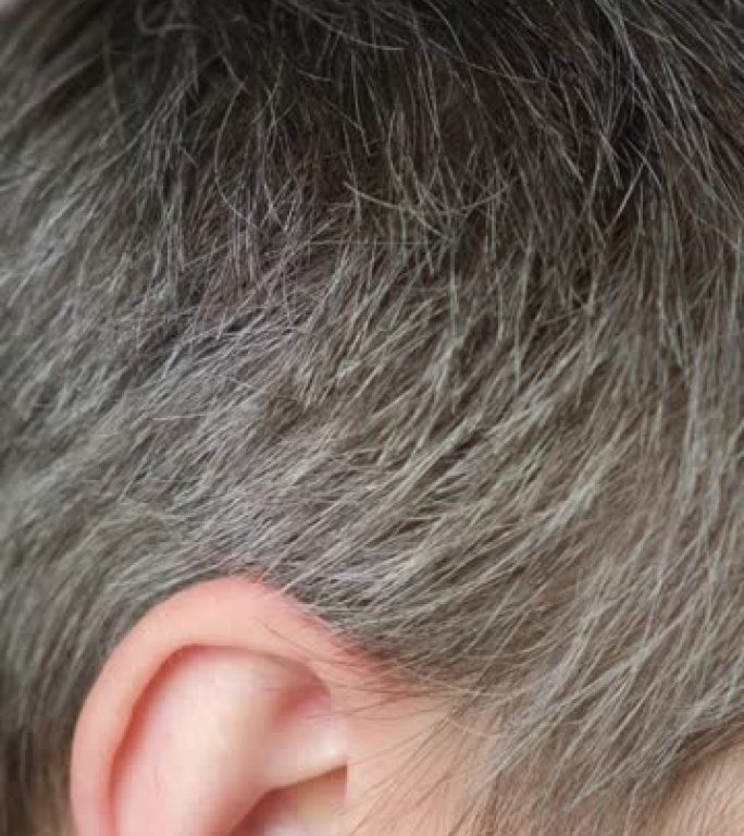 一个白发男子在太阳穴上露出白发。头发护理，男性白发的外观。