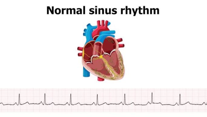 心电图正常窦性心律的心脏动画