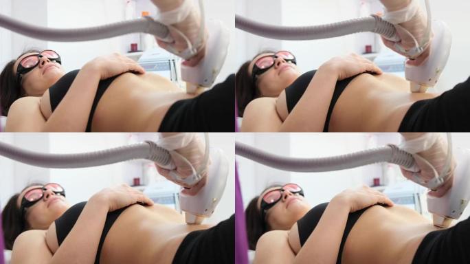 专业美容师对年轻女子的腹部进行激光脱毛。4k视频
