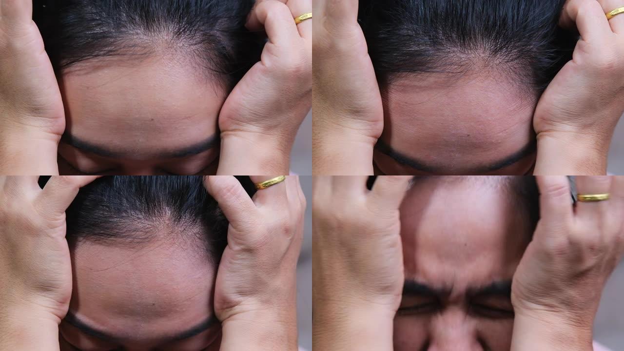 亚洲妇女触摸前额患有头痛偏头痛或抑郁症。陷入困境的女人感到压力和担忧。健康和医学概念。