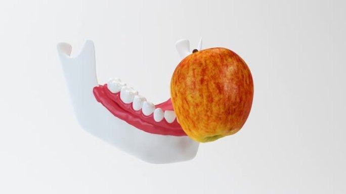 下部种植体支撑的全口义齿红苹果和义齿未能图示。植入。正畸学。