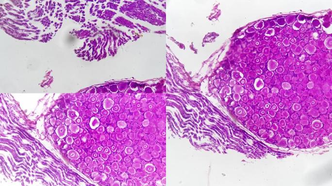 在200倍放大的光显微照片下拍摄的人类脊髓神经节切片