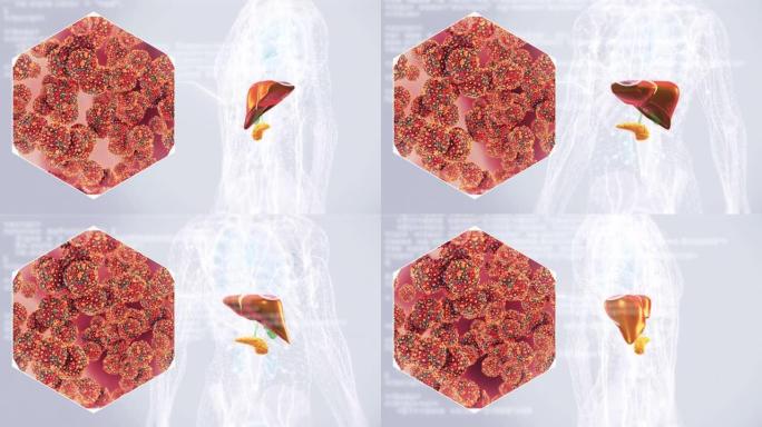 肝炎病毒的肝脏感染。