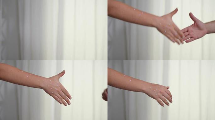 双手在慢动作中伸展握手，男性手掌拒绝摇动患有猴痘皮疹的女性手臂。无法辨认的年轻高加索病女子在室内问候