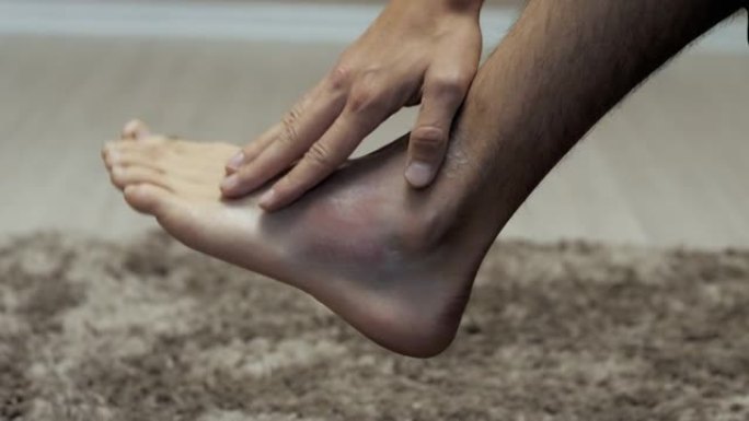 一个男人的手的特写镜头在家里碰到了一个大瘀伤的脚，扭伤和受伤