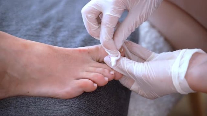 专业美容师使用一次性手套用丙酮溶液和棉垫去除客户脚趾指甲上的旧指甲油，修脚医生准备女性脚浸泡在温水中