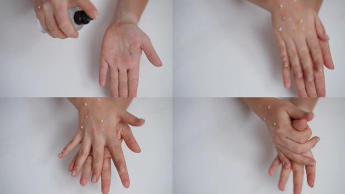 慢动作在患病女性手的手掌上近距离喷洒消毒剂。面目全非的白人妇女患猴痘皮疹擦手消毒。