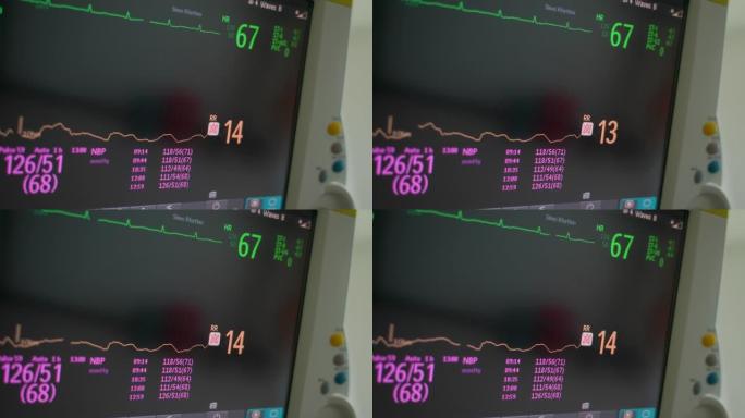 医院ICU监护仪中的心率