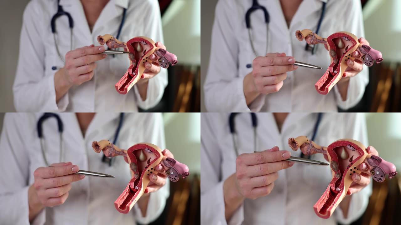 妇科医生显示子宫和卵巢的塑料模型特写