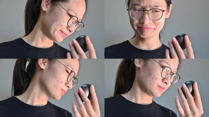 年轻的亚洲妇女担心会导致痤疮发炎和痤疮疤痕出现在她的脸上。