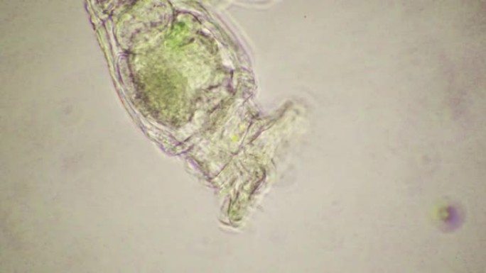 显微镜下轮虫