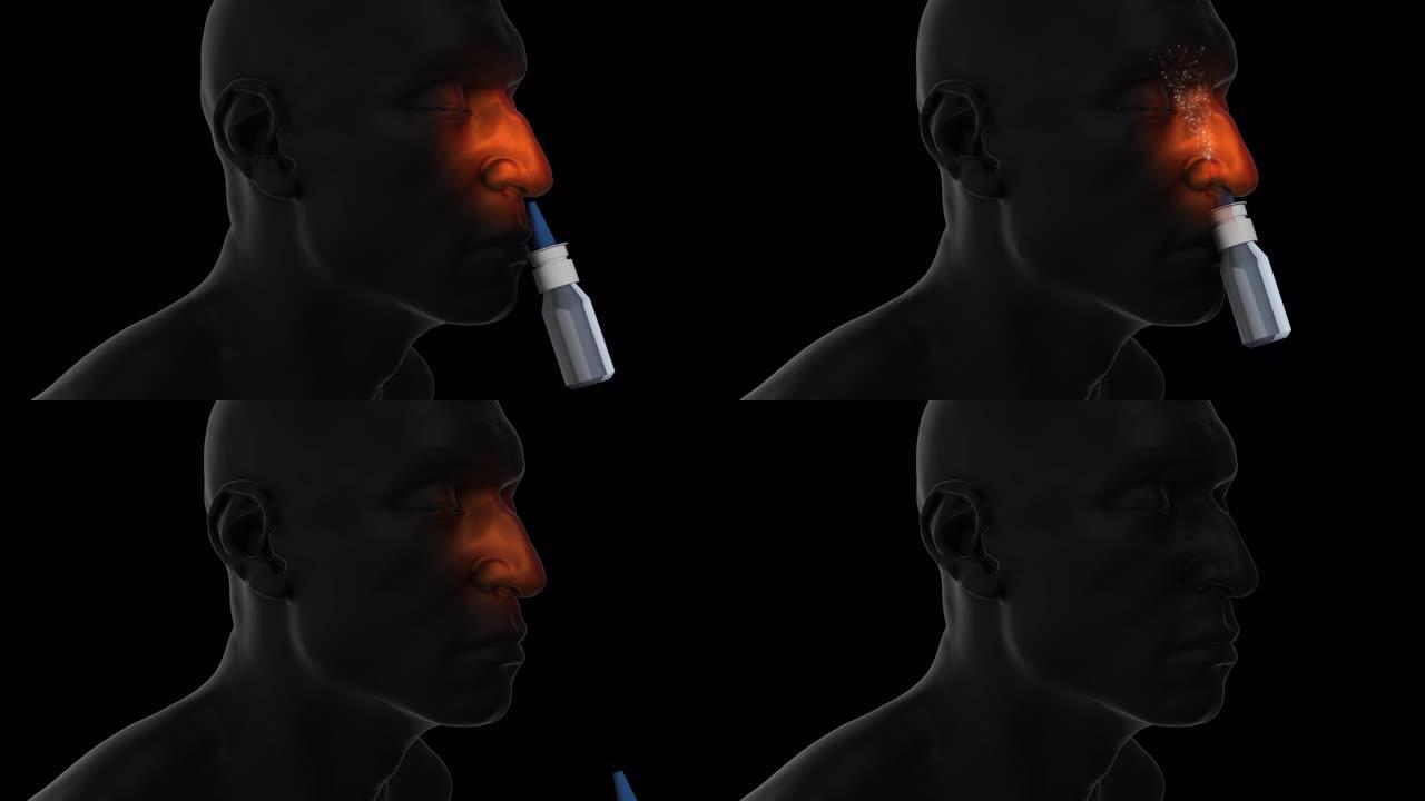减充血剂鼻喷雾剂-男性-黑色背景