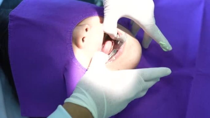 牙医在牙医诊所复制模型牙齿的特写镜头