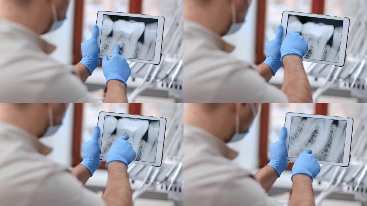 男性牙医医生分析牙齿口腔定期检查在平板电脑上使用数字x射线特写