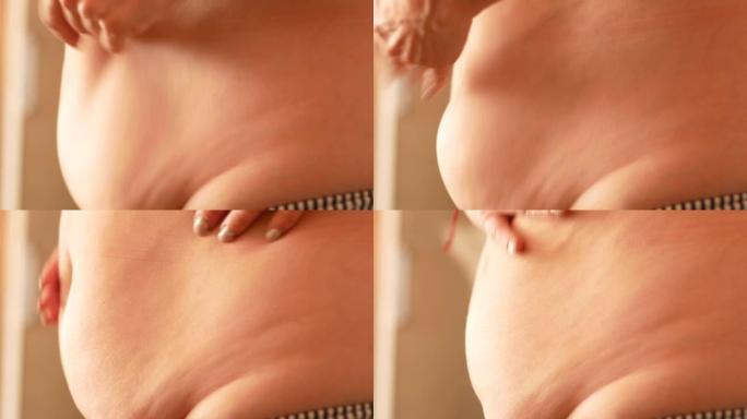 肥胖和营养不良导致的大女性腹部特写。减肥。燃烧女人的腹部脂肪。暴食，肥肚，荷尔蒙变化