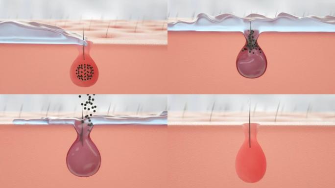 3D动画特写修复皮肤污垢去除。痤疮清洁。深层清洁皮肤。皮肤毛孔。皮肤毛孔清洁。