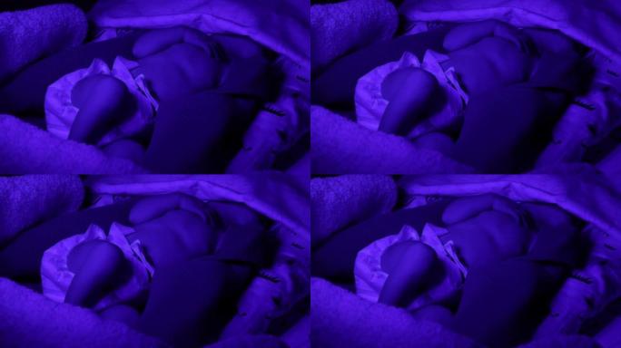 新生儿躺在新生儿重症监护室的紫外线灯下。