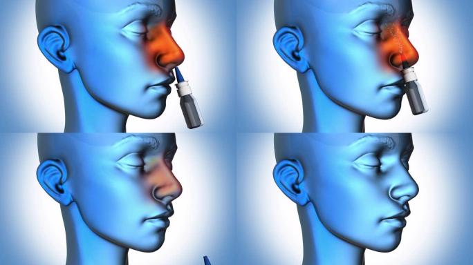 减充血剂鼻腔喷雾-女人-蓝色背景。