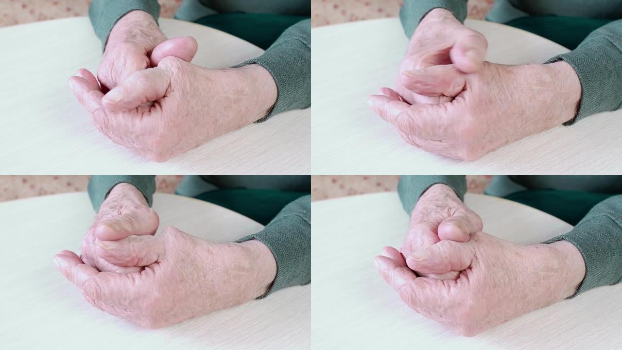 一个老人皱巴巴的老疲惫的手的特写。这个人擦着手，抚摸着手臂上的骨头。养老金领取者的手。选择性聚焦，浅