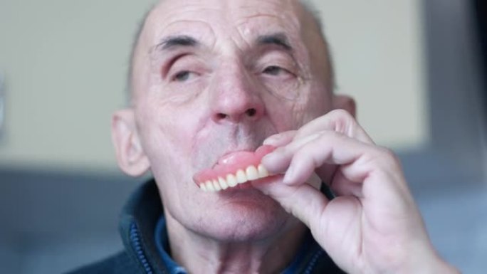 70岁的白人老人去除可移动假牙。成年后牙齿脱落。养老金领取者的牙科义肢。使用假牙的不便。