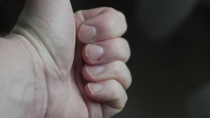 指甲上有指甲的男性手特写视图。