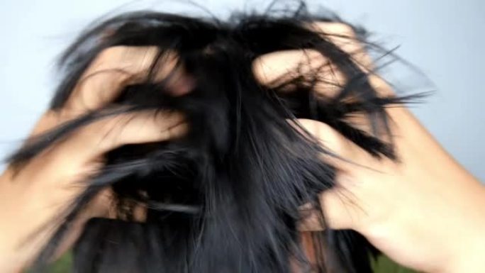东南亚男子因头皮屑而挠痒痒的头和头发