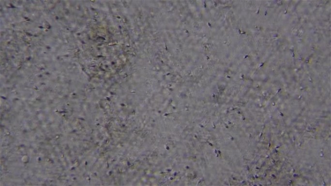 显微镜下看到的精子