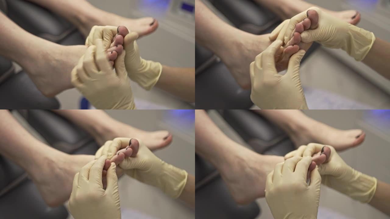 足病医生用手按摩手指，病人的脚