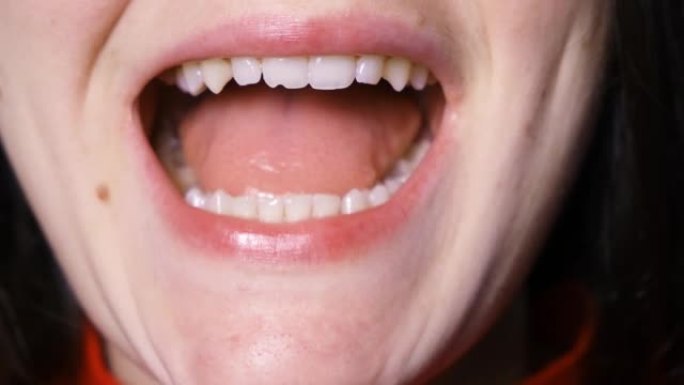 颞下颌关节功能障碍的患者显示错牙合