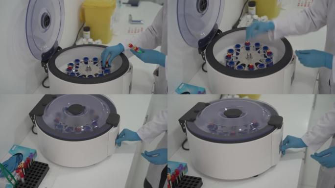 富血小板血浆制剂。手上有血的管子。离心机。戴着手套的医务人员将管子插入离心机。用于离心血液和尿液检测