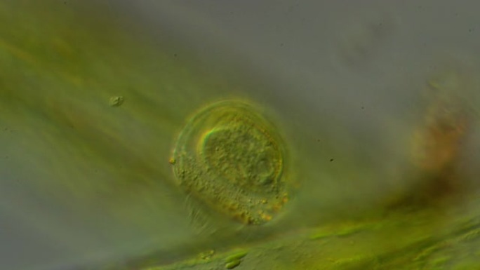涡旋菌的显微镜检查