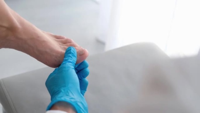 用指甲上的真菌1英尺的特写镜头由医生用剪刀清洁医生戴手套。甲癣: 指甲从甲床上脱离。