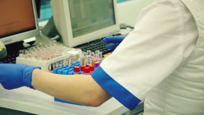 PCR测试-Covid-19.Testing血管。女医生在实验室对试管进行分类。抗体检测