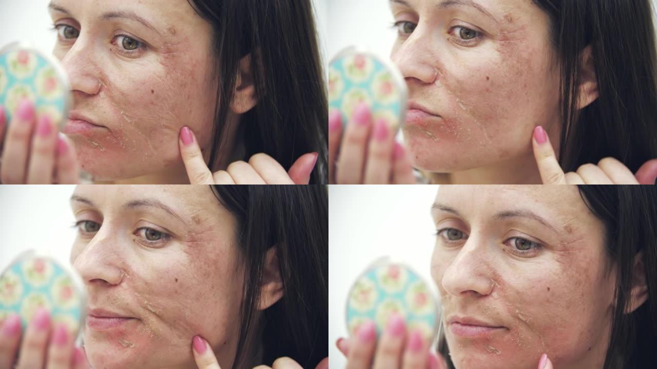 4k慢动作视频特写女性脸，皮肤干燥照镜子。