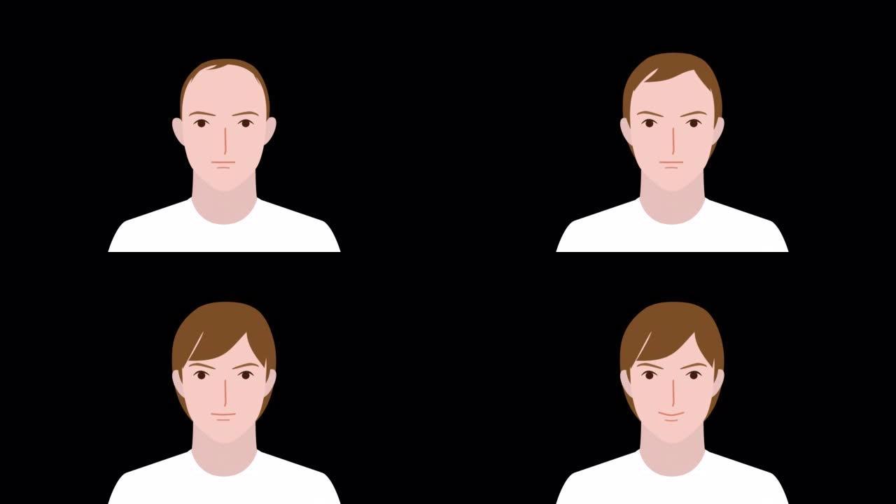 头发越来越多的男人的脸。插图视频