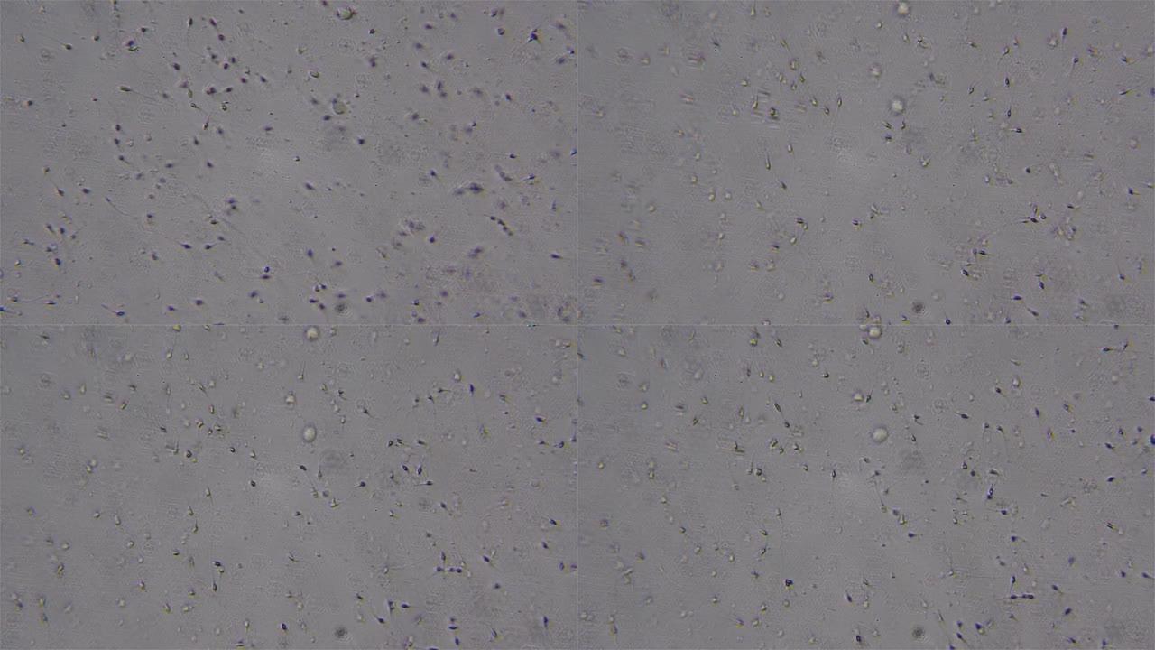 显微镜下看到的精子