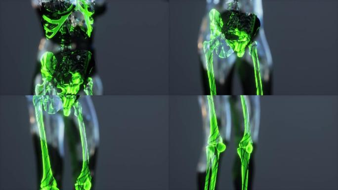 X射线全身骨骼在亮度发光